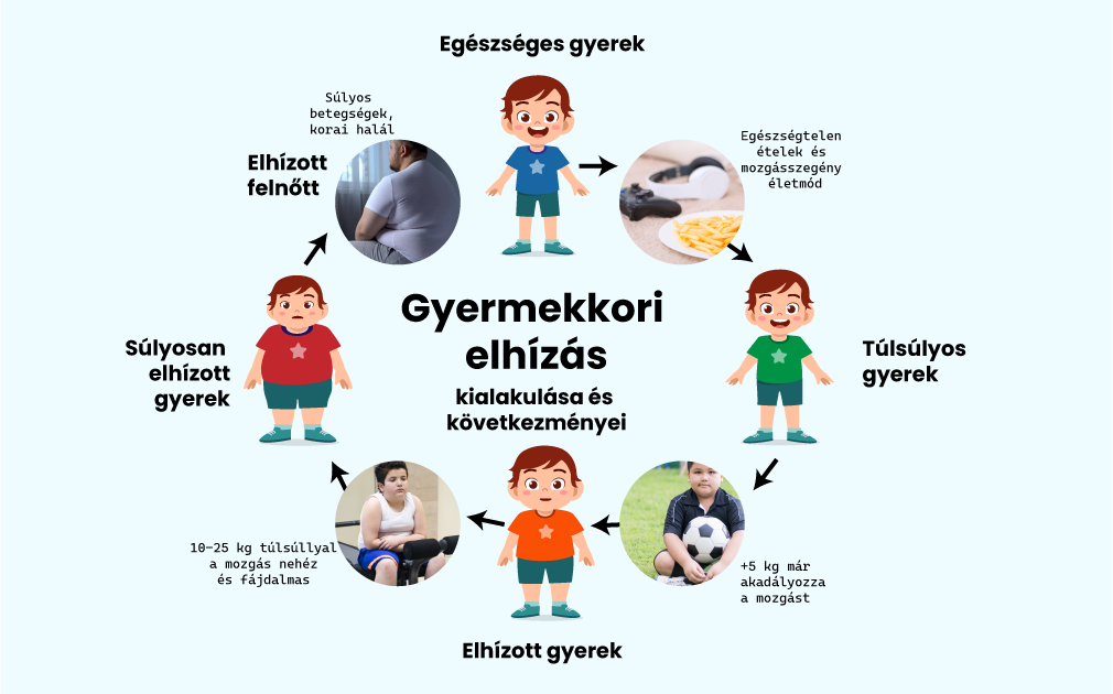 Gyermekkori elhízás: okok és következmények